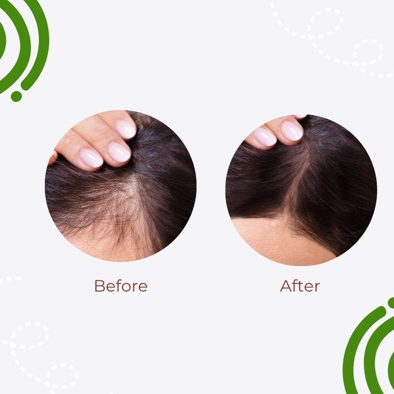 Sprouting Hair Oil | Ayurvedic Oil for Hair Growth & Thickness