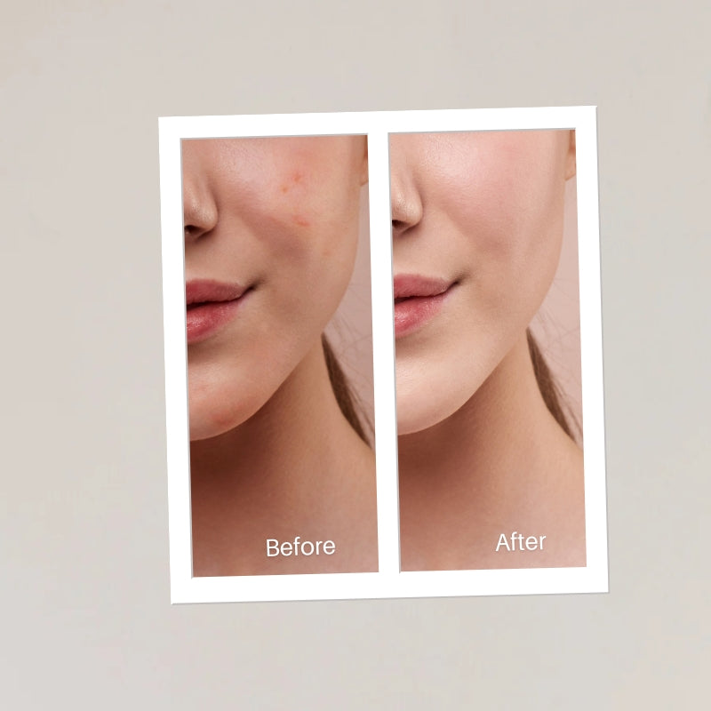 Replenishing Face Pack | Ayurvedic Detox and Glow