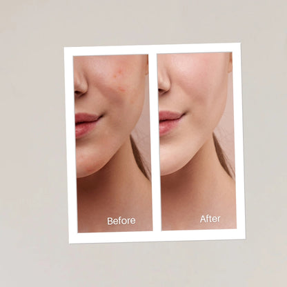 Replenishing Face Pack | Ayurvedic Detox and Glow